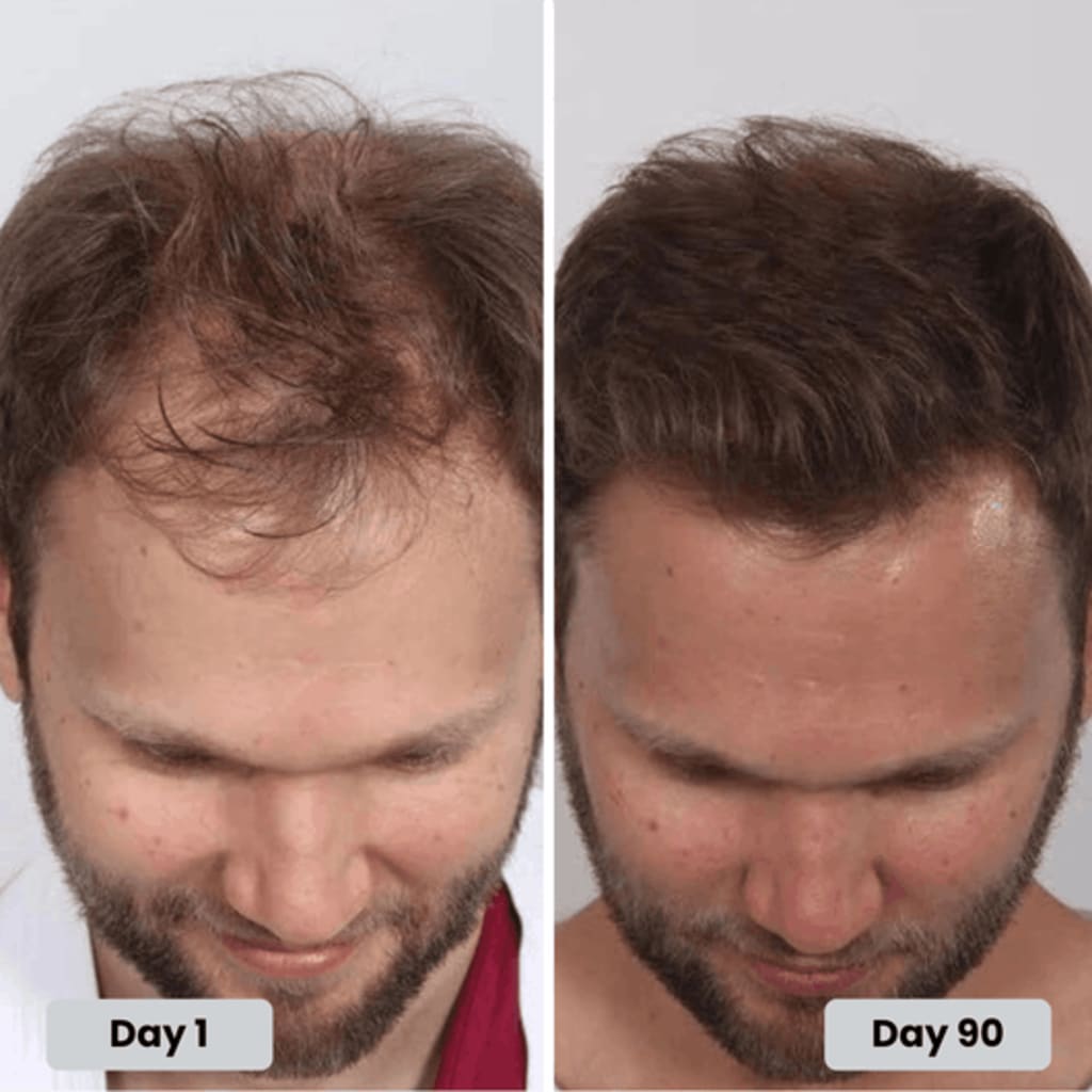 Hair progress over several months